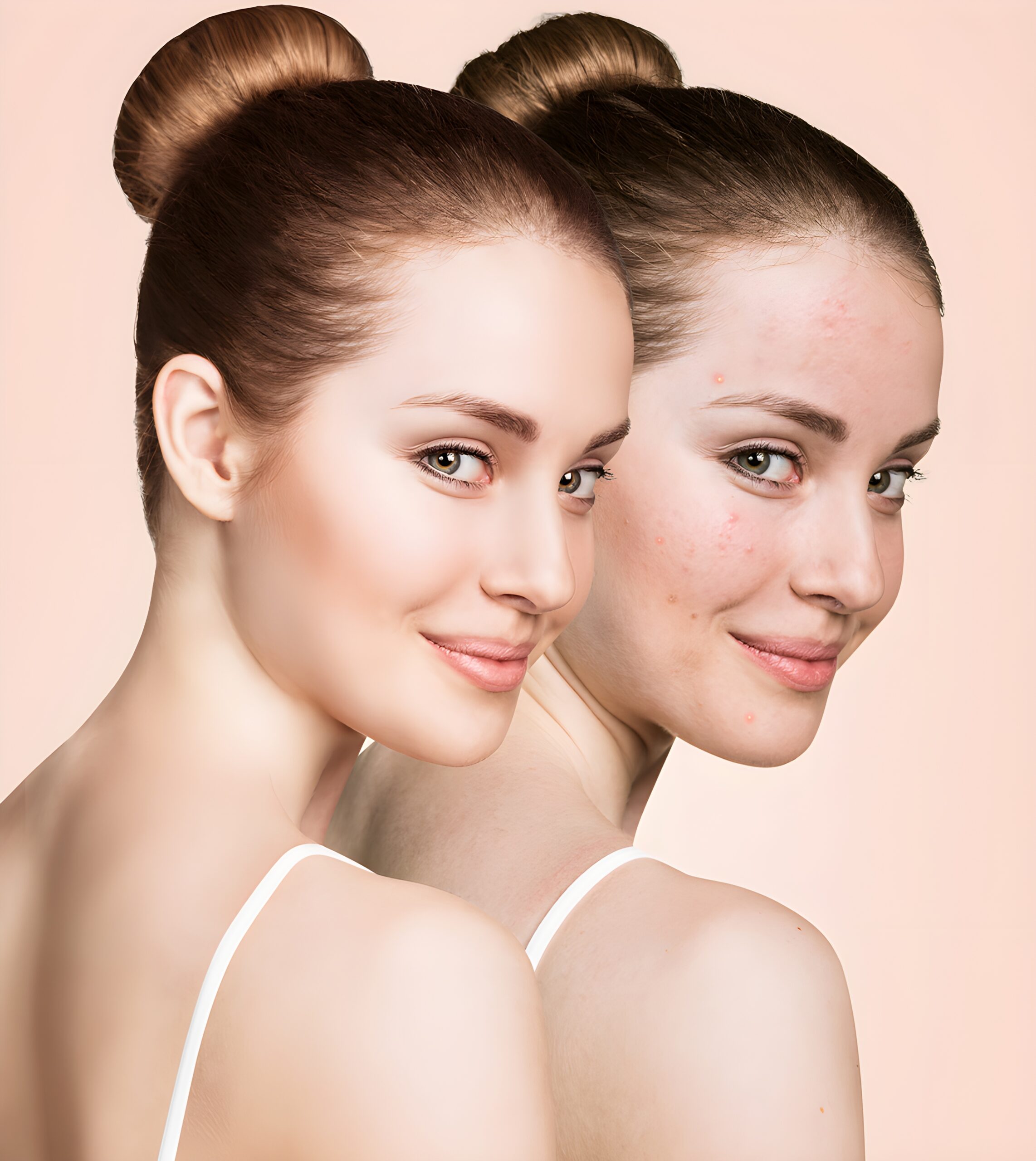 nohat_upscaled_x4_nW2jnb